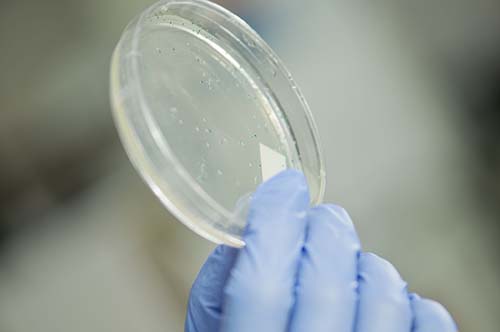 Important Things To Know About Plasmid Purification