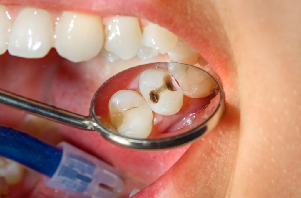 Emergency dental service near me