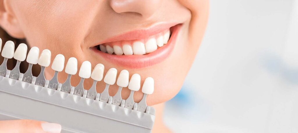 Veneers in Century City